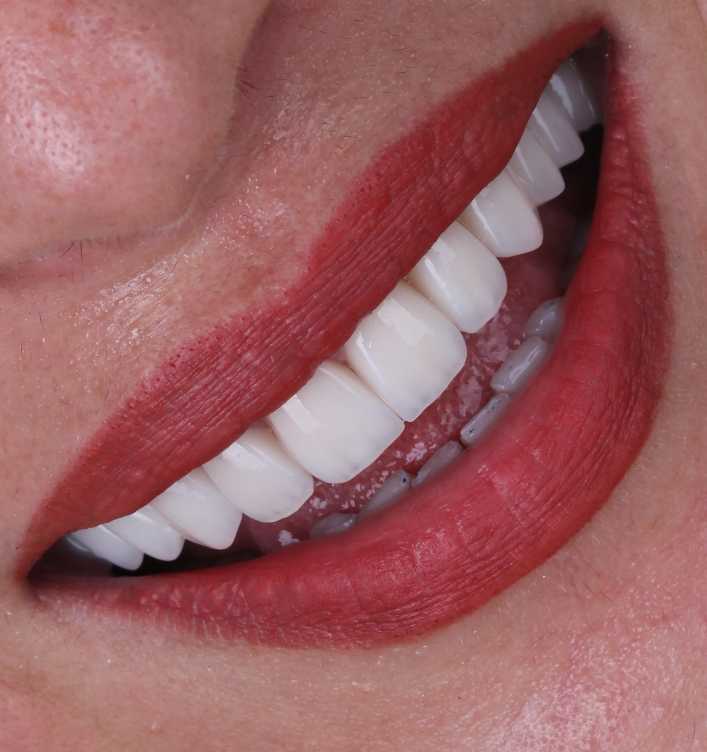 Periodontoloji